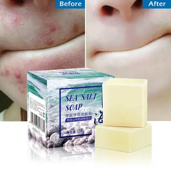 

100g Sea Salt Handmade Soap Cleaner Removal Pimple Pores Face Goat Basis Acne Care Soap Moisturizing Milk Treatment Wash T3J6
