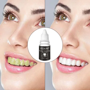 

Tooth Whitener Teeth Whitening Pen Whitening Teeth zh