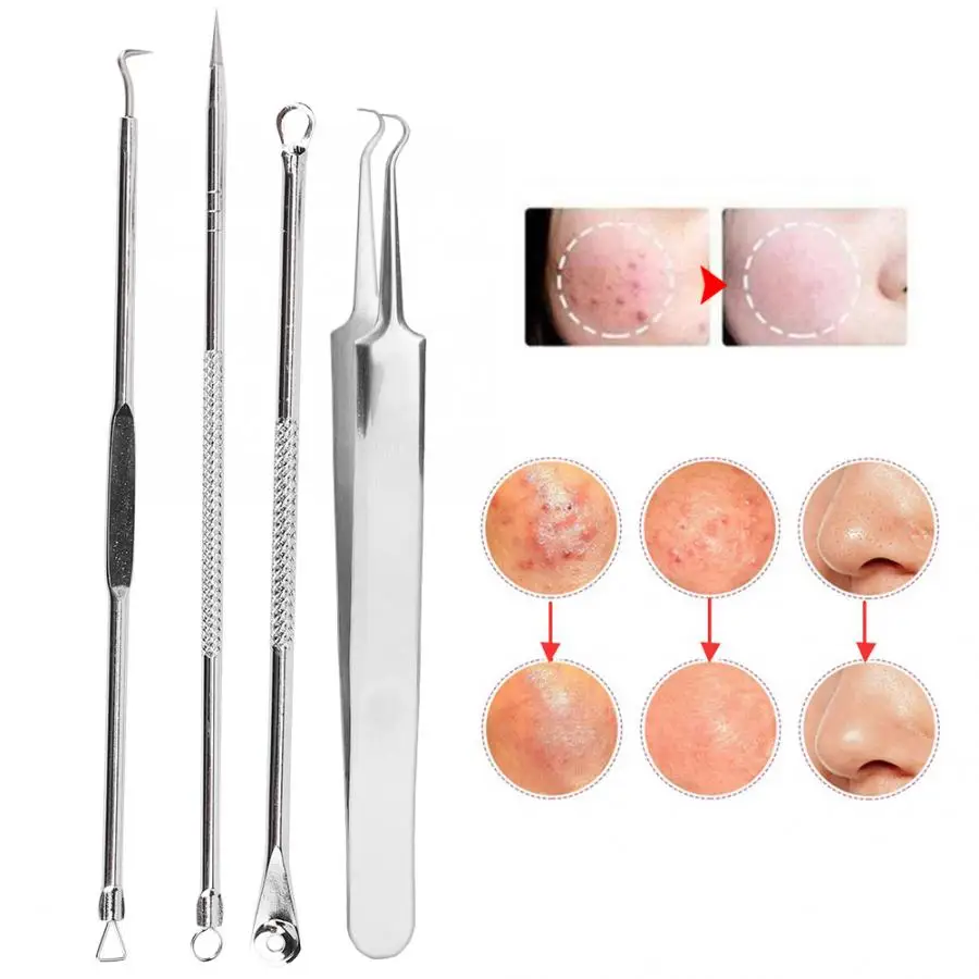 Acne 4pcs Pimples Needles Set Blackheads Removal Pin Extractor Facial Cleansing Tool Remover for Face Care | Красота и здоровье