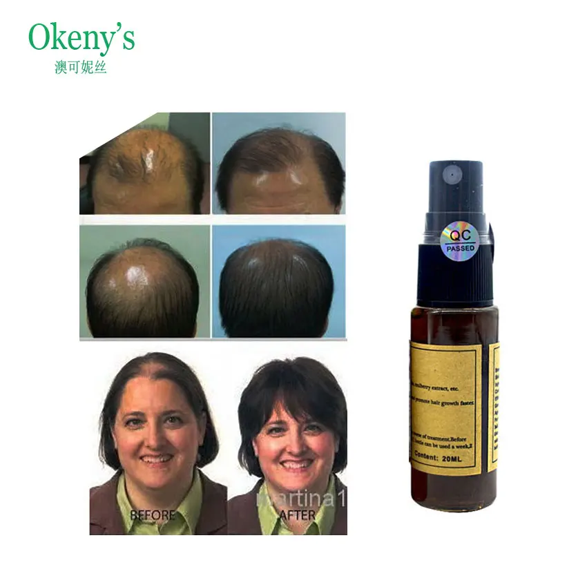 Okeny's Hair Growth Spray 20 мл жидкие продукты для быстрого роста волос Yuda Pilatory анти-седые волосы продукт для лечения выпадения волос