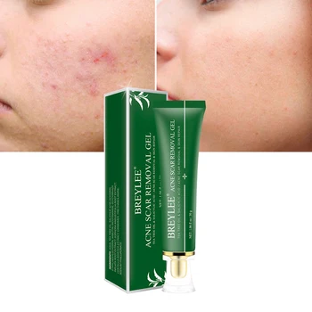 

BREYLEE Acne Scar Removal Gel Tea Tree Skin Repair Gel 30g Skin Care Acne Scar Removal Gel Tea Tree Skin Repair Gel
