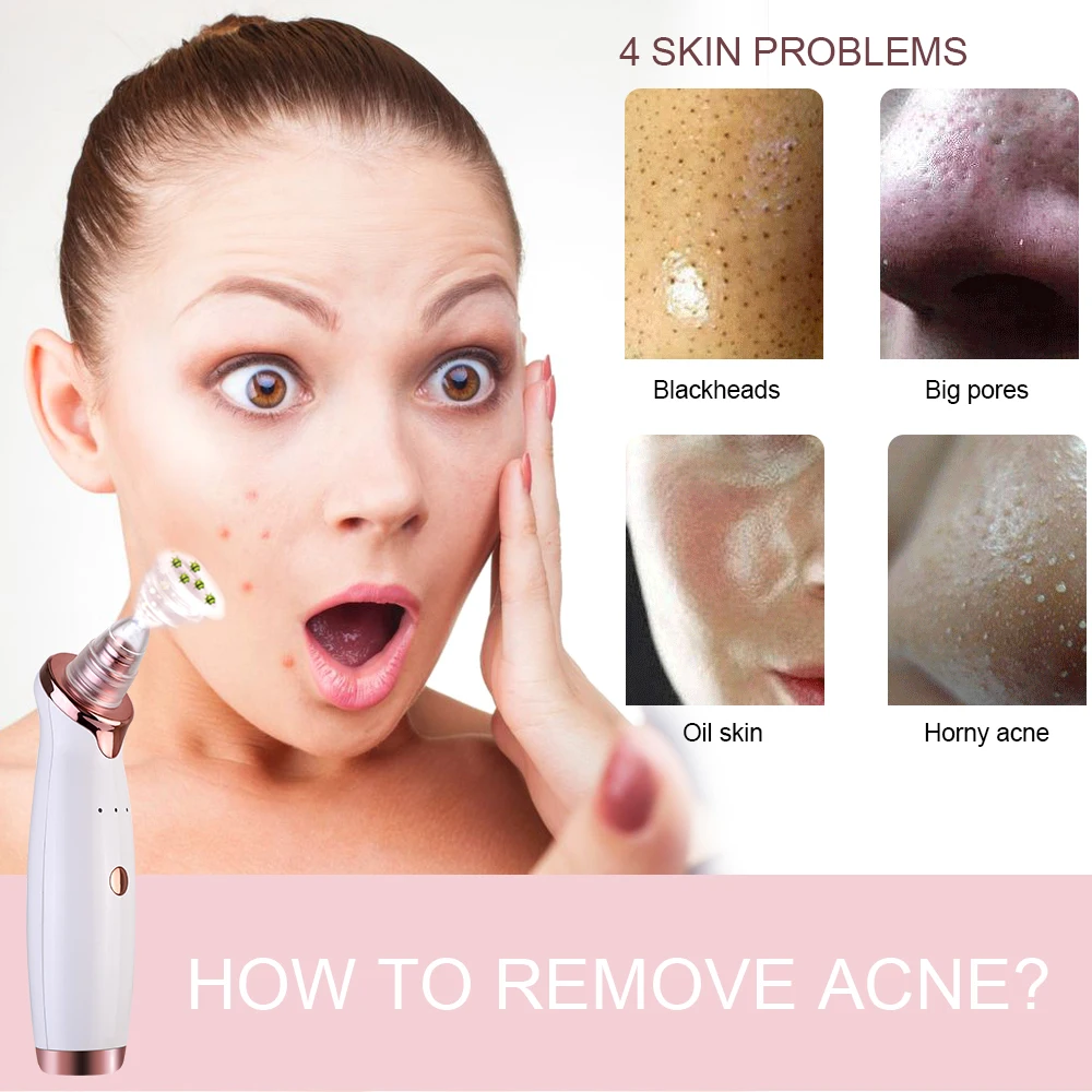 Вакуумный удалитель Blackhead микродермабразия машинка для алмазного пилинга Blackhead акне вакуумный очиститель пор вакуум