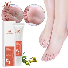 Foot Care Cream Infection Onychomycosis Fungus Treatment Foot spa Pedicure Herbal Detox Anti Fungal For legs 15g