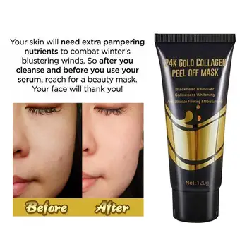 

Gold tearing nasal mask Lightens fine lines Lifting blackheads moisturizing shrink firming mask Whitening pore L4F0