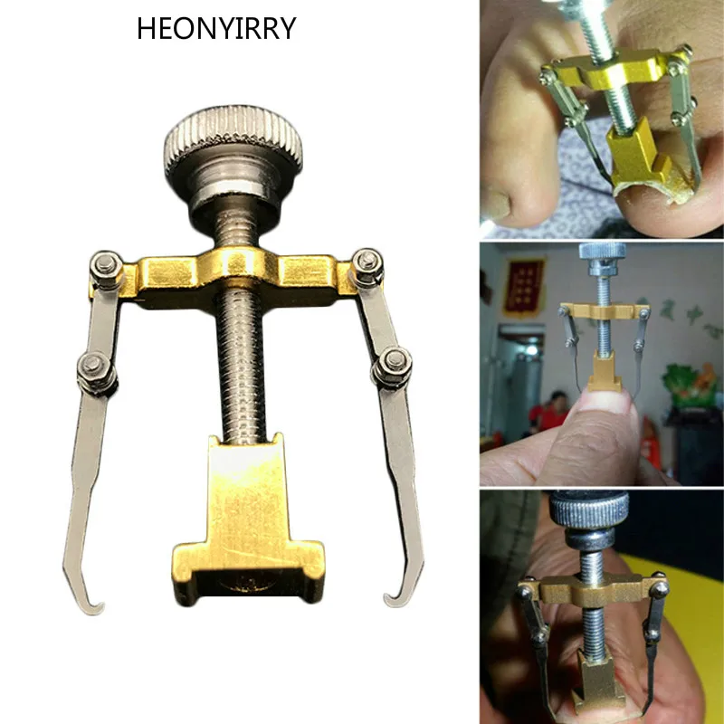 Ingrown Toenails Pedicure Foot Nail Care Tools File for Feet Orthotic Acronyx Ingrowing Nail Onyxis Bunion Corrector for Toes