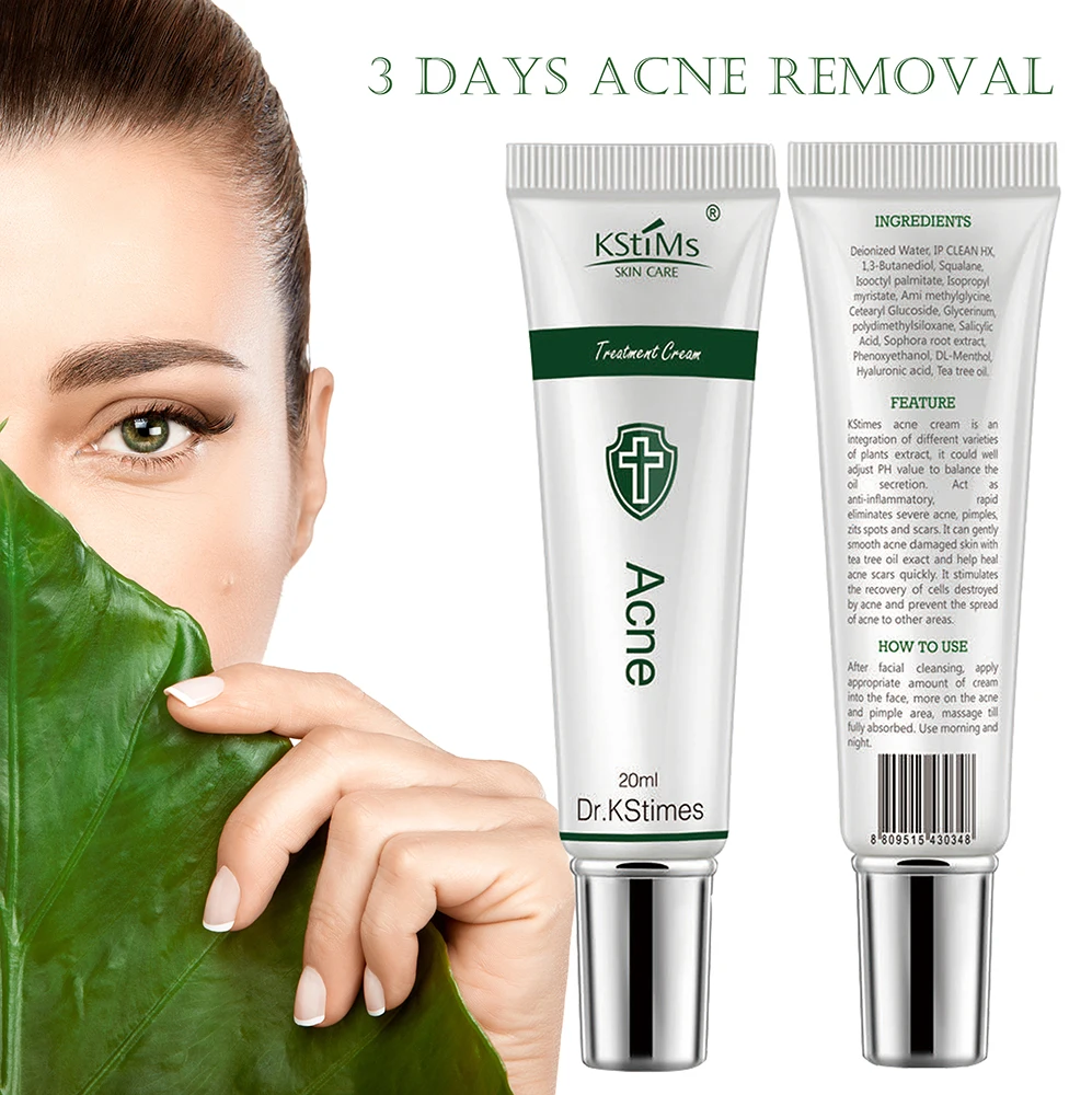 best acne spot treatment cream