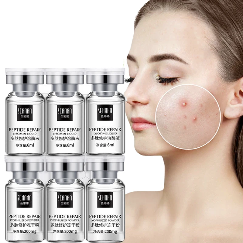 Peptide Lysozyme Lyophilized Powder Repair Skin Hydrating Anti-aging Skin Tightening Acne Oligopeptide - 1 Face Serum Skin Care