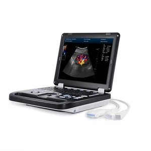 Image for Notebook 3D Color USG Doppler DC30 with libattery 