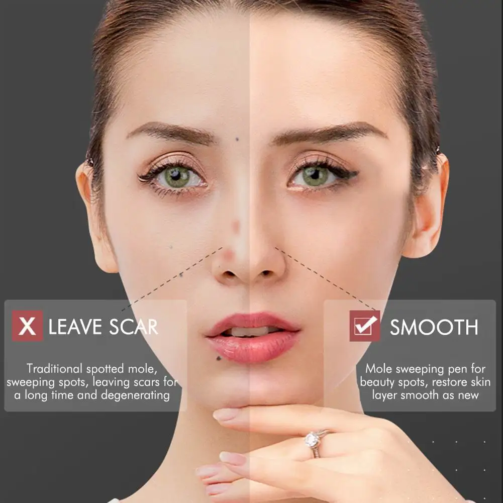 Laser de Remoção de Toupeira Remoção de Toupeira Cuidados com a Pele Removedor de Mancha Caneta Plasma Tatuagem Verruga Freckle Facial Remoção Tag Elétrica Escuro Pen 10 Utensílios de cuidado facial