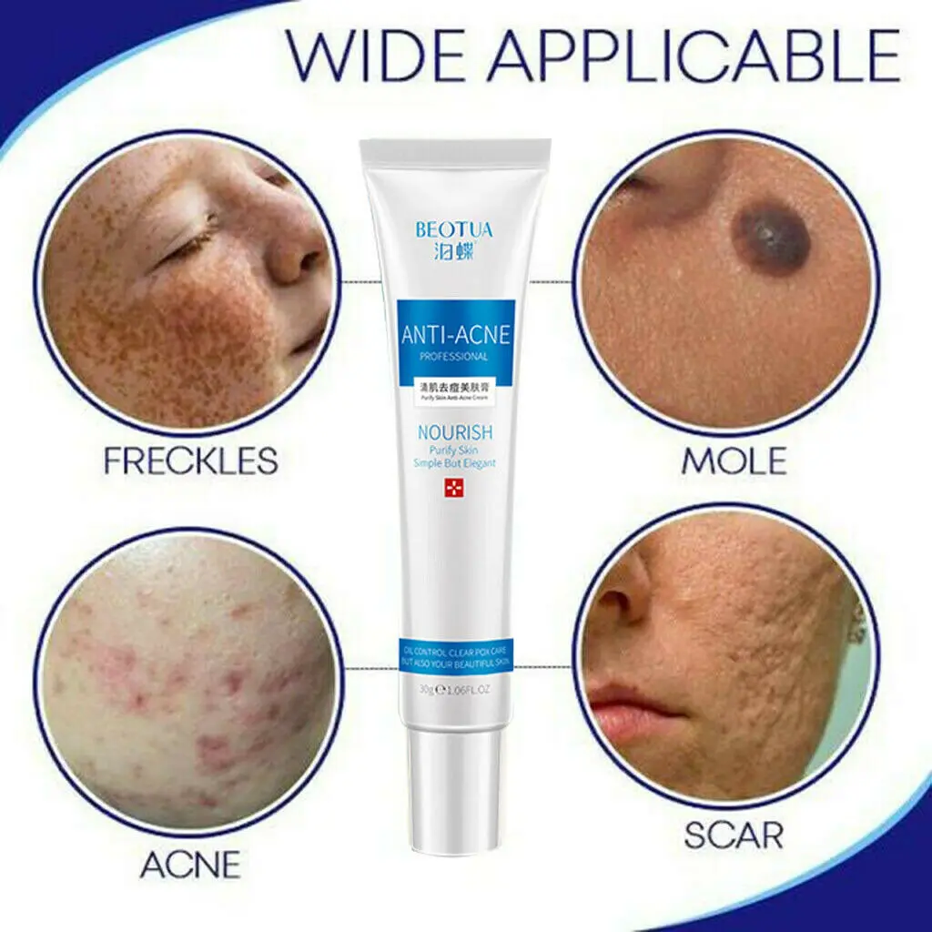 30 г дневной крем с гиалуроновой кислотой для удаления угрей сужение пор