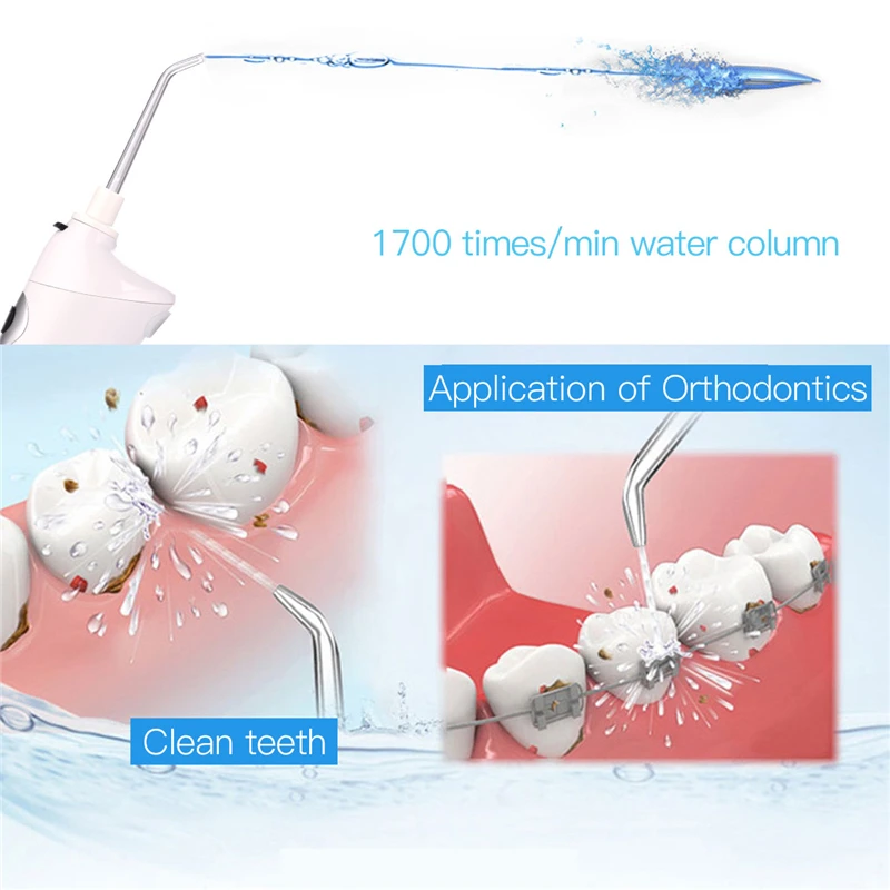 

CkeyiN Portable Cordless Water Flosser Electric Oral Irrigator Dental Water Jet Teeth Cleaning Floss Rechargable Tooth Cleaner