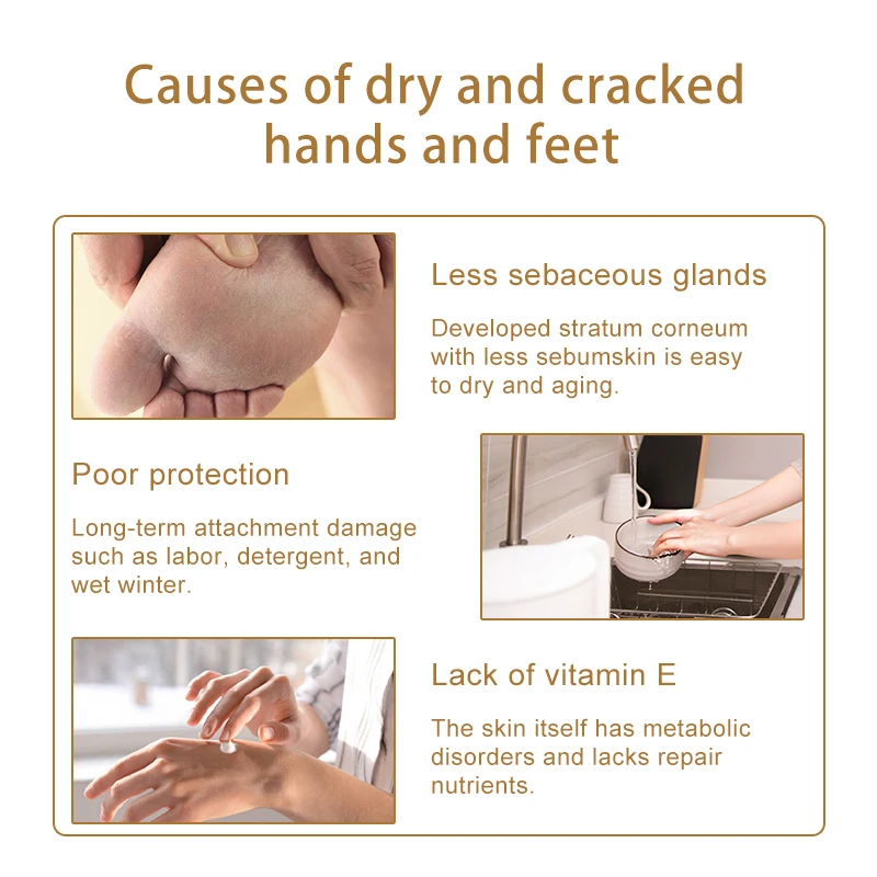 Horse Ointment Miracle Moisturizing Hand Cream Brands Anti Aging Whitening Hand Lotion Creams For Hands Bioaqua Skin Care P1056