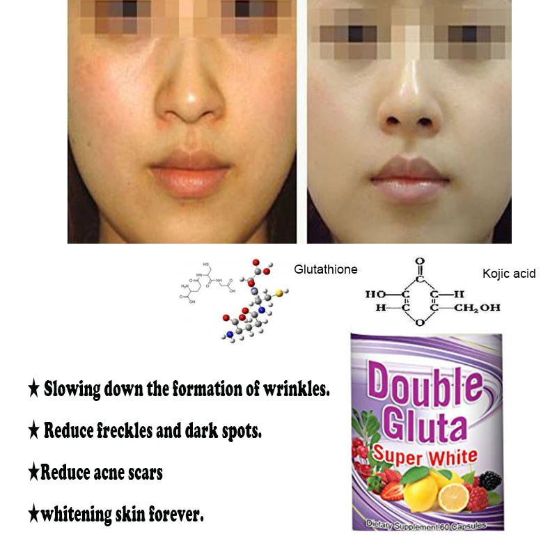 acne and aging skin
