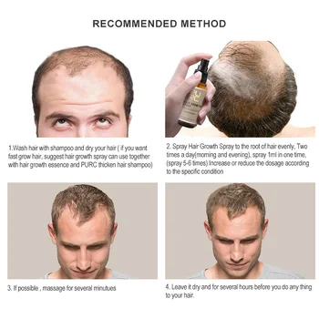 

Home Hair Growth Spray Ginger Extract Portable 30ml Scalp Professional Regrow Serum Germinal Safe Cure Prevent Loss Hairdressing