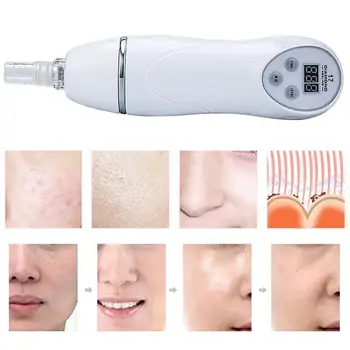 

Vacuum Electric Nose Face Deep Cleansing Microdermabrasion Dermabrasion Machine Vacuum Peeling Skin Rejuvenation Tool