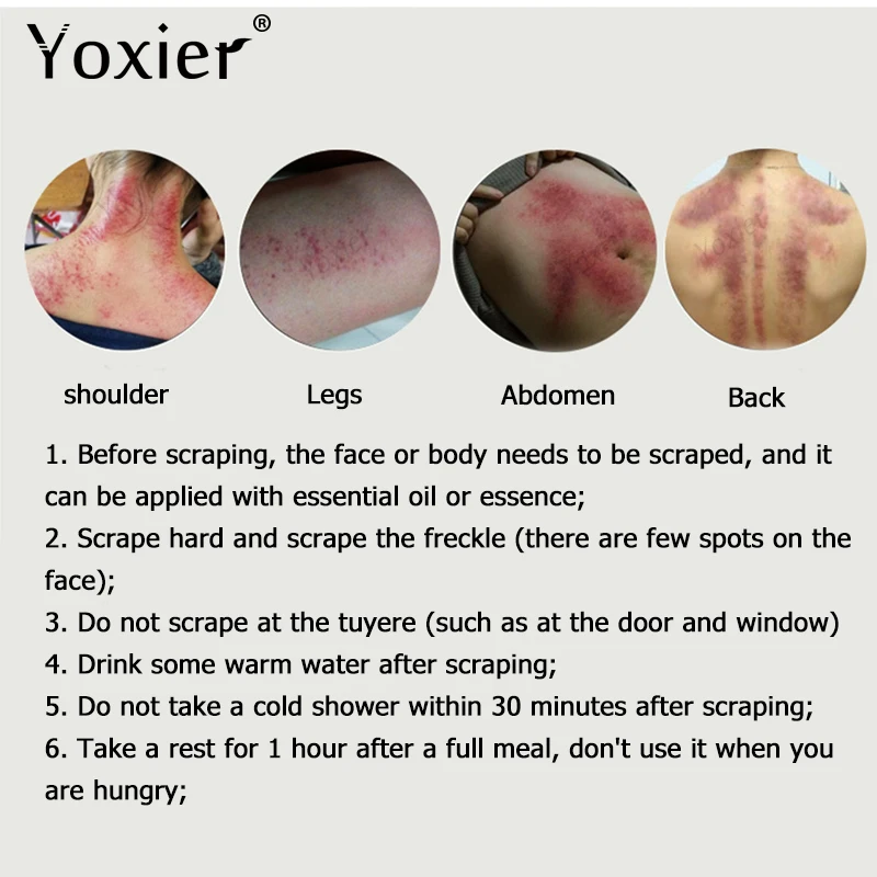 Yoxier массаж скребком гуаша акупунктурный уход за лицом спа массажер для лица