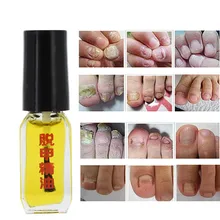 3 дня эффект грибка эссенция для удаления жидких грибков Лечение ногтей яркий ремонт ногтей анти-инфекция Уход за ногами онихомикоз