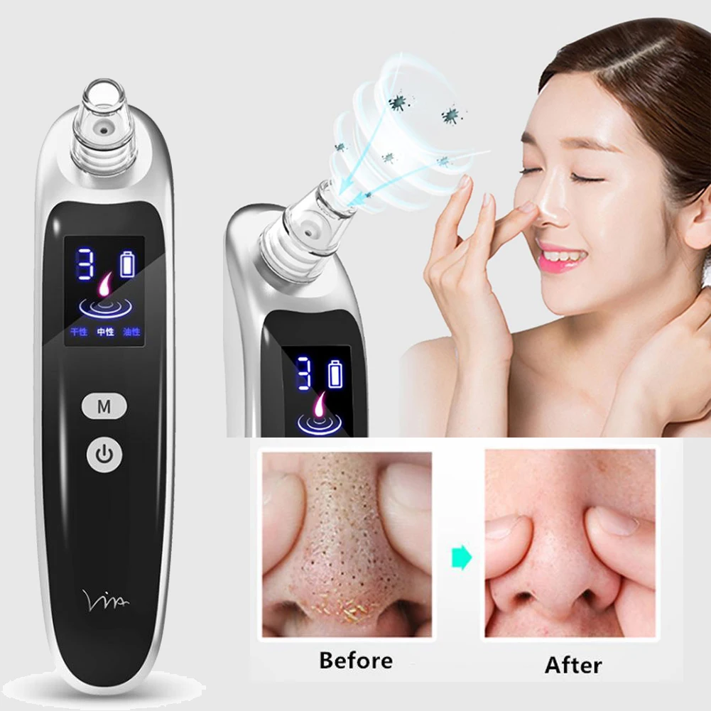 

Blackhead Remover Skin Care Pore Vacuum Acne Pimple Removal Vacuum Suction Tool Facial Diamond Dermabrasion Machine Face Clean