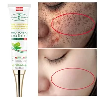 Aichun Whitening Freckle Cream Remove Melasma Acne Spot Lighten Dark Spots Pigment Melanin Hydration Moisturizing Face Care 30ml 1
