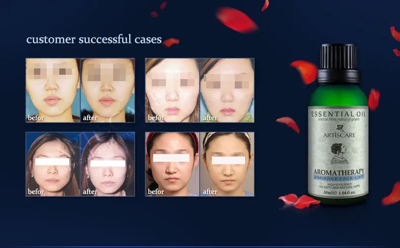 face-lift_08