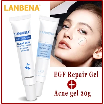 

LANBENA Anti Acne Moisturizing Cream Oil Control Shrink Pores Oily Skin Acne Face Repairing Shrink Pores Aloe Vera Gel Snail