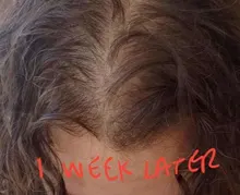 Productos para la pérdida de cabello, Productos naturales sin efectos secundarios para el crecimiento rápido del cabello y el rejuvenecimiento del cabello