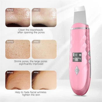 

Skin Shovel Machine Heating Compress Ultrasonic Beauty Skin Shovel Instrument Import Ion to Remove Blackhead and Pore Cleaning