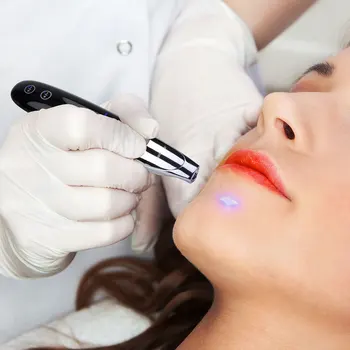 

Picosecond Laser Spot Mole Pen Laser Picosecond Red Blue Light Hand Held Picosecond Beauty Pen Picosecond Laser Beauty Instrumen