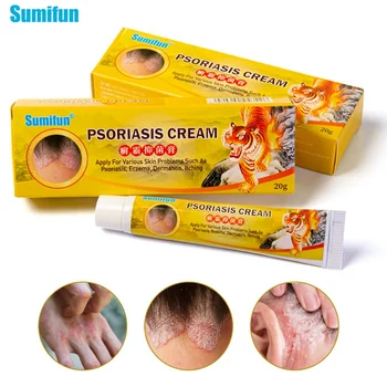 

20g Eczema Cream Natural Ointment Psoriasi Eczma Cream Dermatitis Eczematoid Inhibit Bacteria Itch Item Care Works Well