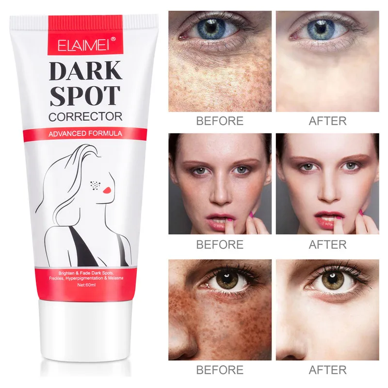 ELAIMEI Advanced Formula Dark Spot Corrector Cream Powerful Whitening