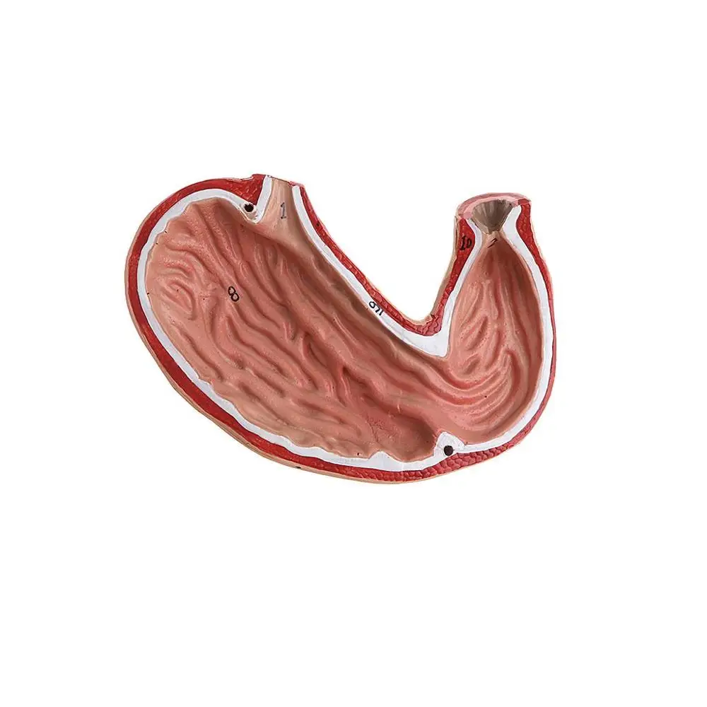 Съемная анатомическая модель с человеческим желудком 2 части 1:1 Lifesize|ulcer| |