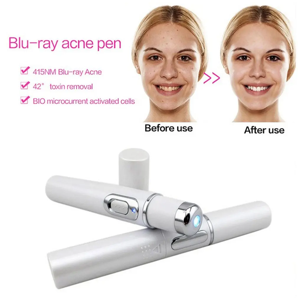 Kd-7910 лазерная ручка для удаления акне Blu-Ray ручка для удаления токсинов и морщин Массажная ручка из нержавеющей стали