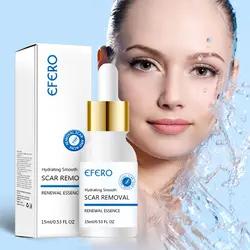 EFERO Сыворотка для лица для удаления акне крем для лица отбеливающая эссенция уход за кожей Ageless Гиалуроновая кислота Acne Treatment Acido Hialuronico