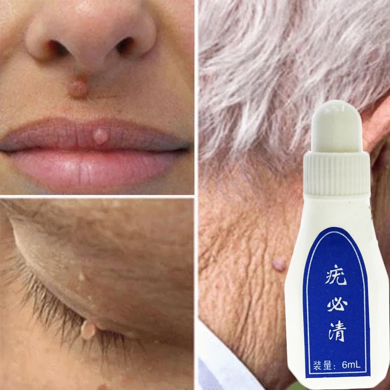 2_ffb524e4-48e1-4e6c-afb4-8cfcebef120d_720x