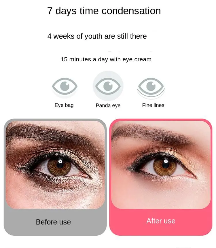 Dispositivo de Cuidados com os Olhos Electirc Inteligente Olho Massageador Anti Rugas Olhos Massagem Fadiga Aliviar Círculos Escuros Remover Aquecido Relaxar 20 High Quality Beleza e saúde