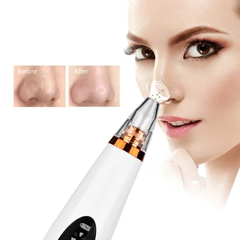 

Electric blackhead acne removal instrument to give girls gifts deep cleansing skin care machine vacuum suction blackheads