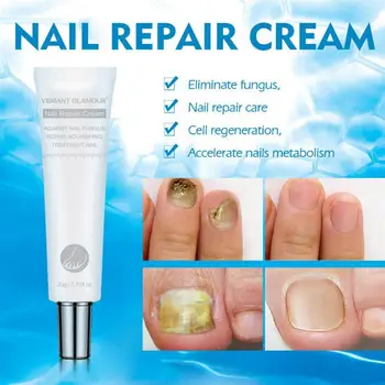 

1pc Toenail Cream Premium Nourish Practical Convenient Treatment for Toenail