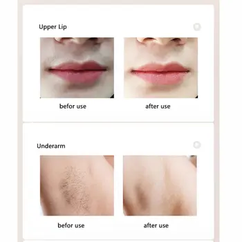 

Painless Laser Hair Remover Photon Women Permanent Epilator Hair Removal Bikini Body Face Under Hair Removal Apparatus