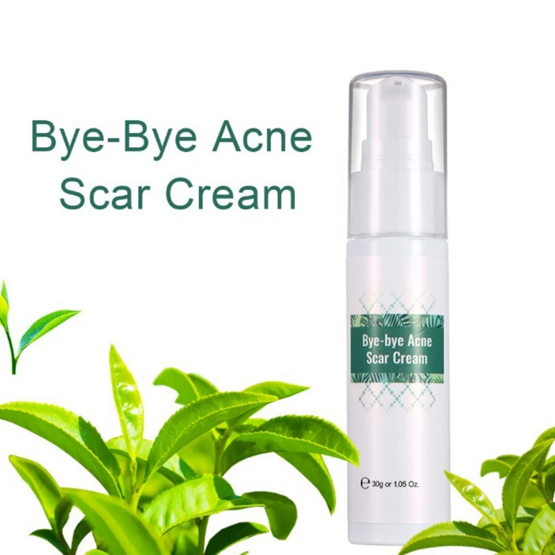 Гель для удаления прыщей Acnes разбавленные угри, прыщи, крем для очищения пор носа, сыворотка для лица, эссенция чайного дерева