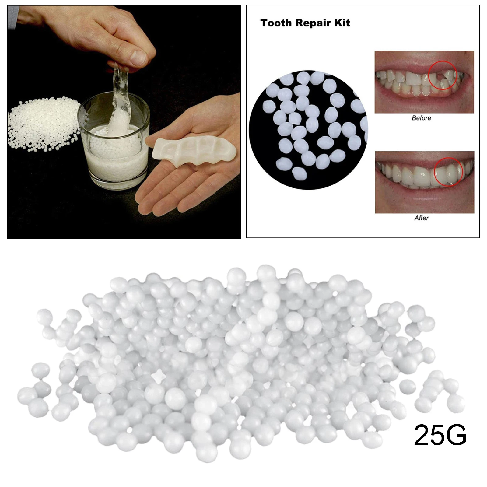 Temporary Tooth Repair Kit Thermal Molding Repair Fitting Bead Denture Repair Fake Teeth Veneer for Filling Missing Broken Teeth