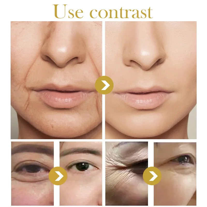Six Peptides Cream Anti Wrinkles Removal Spot Aging Lifting Firming Whitening Face Moisturizer Dropship| |