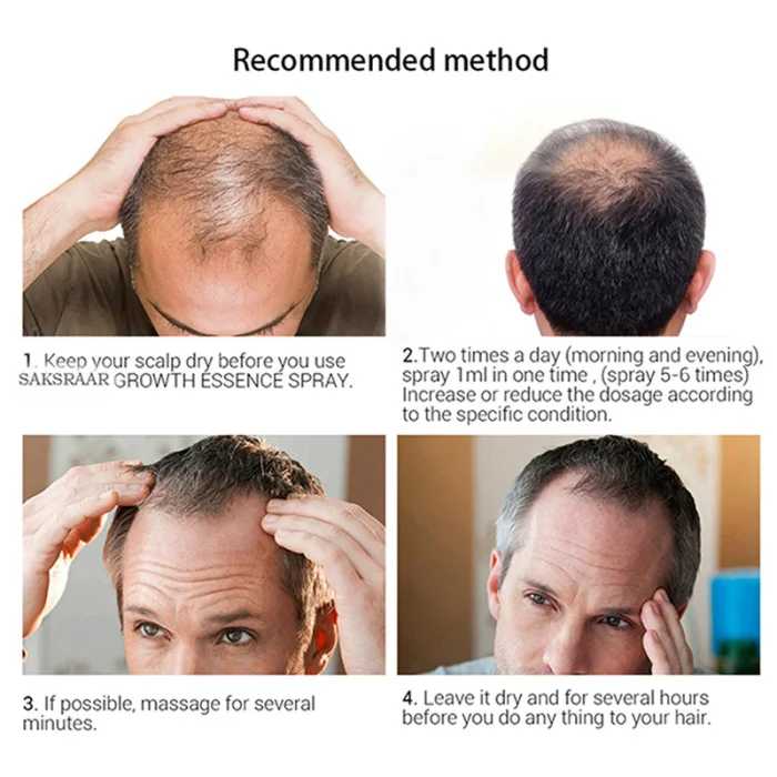 Уход за волосами эссенция Предотвращение выпадения волос эффективный рост питает контроль масла LDO99