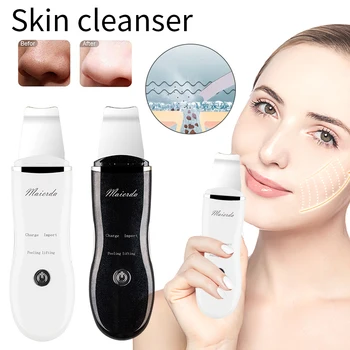 

Ultrasound Vibrate Deep Face Cleaning Skin Scrubber Remove Dirt Blackhead Reduce Wrinkles Facial Lifting Peeling Blackhead Pore