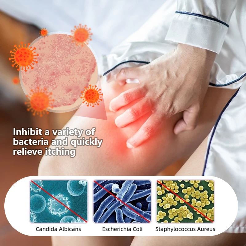 15g Antibacterial Cream Private Vagina Care Leg Pruritus Dermatitis Anti-itch Ointment Intimate Remove Odor Herbal Medical Oil antibacterial anti fungal cream
