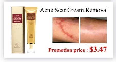 LANBENA Snail Repair отбеливающий крем для лица + Улитка глаз Сыворотки крем для глаз лечение акне Гиалуроновая кислота Улитка Крем дневной крем 2 шт