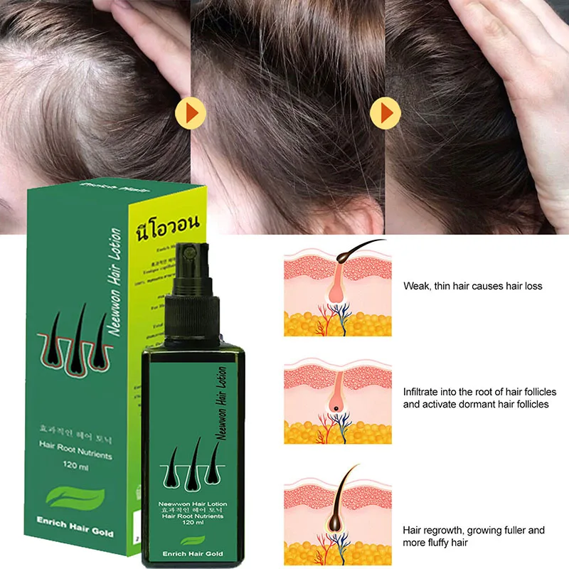 Effective 120ML Hair Growth nutrition Essence Oil Loss Treatment for Men Women Thailand effective hair lotion | Красота и здоровье
