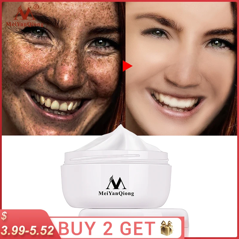 Powerful Whitening Freckle Cream Remove Acne Spots Melanin Dark Spots Face Lift Firming Face Skin Care Beauty Essentials-0