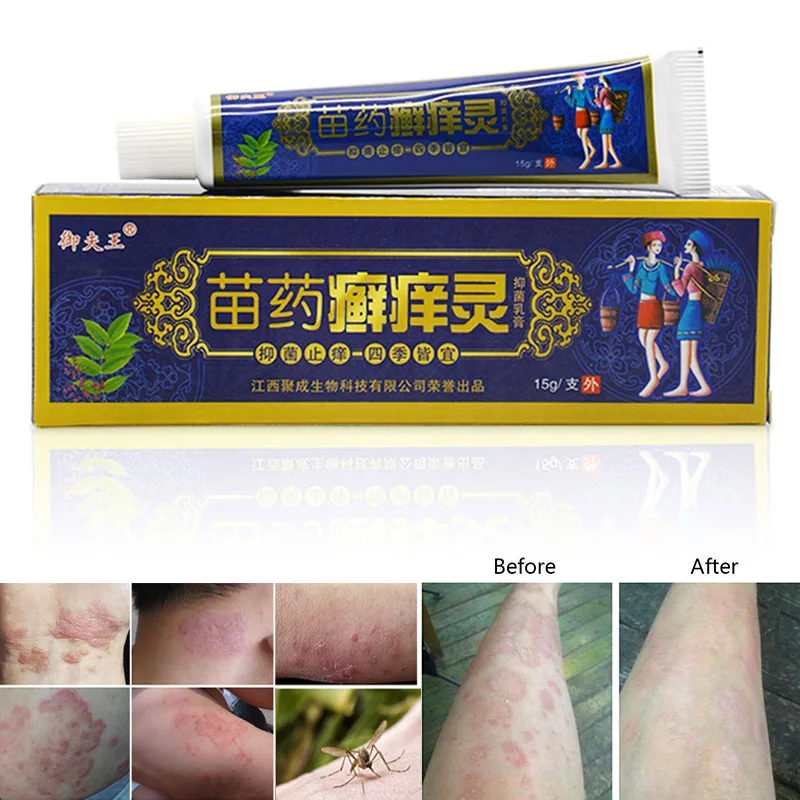 Антипритический травяной крем для кожи проблема псориаза лечение мазь SDFA88