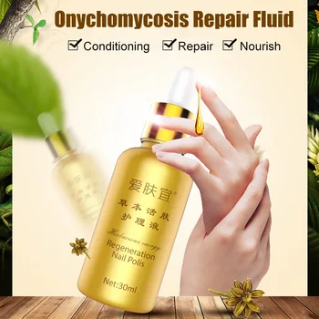 

New 30ml Nail Fungal Treatment Liquid for Toenail Fingernail Anti Fungus Infection Nail Care SCI88