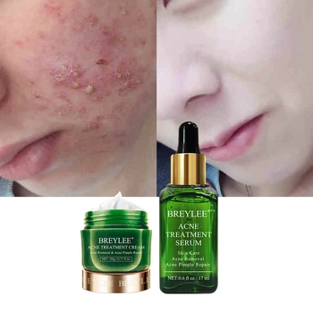 

BREYLEE Face Serum Anti Acne Treatment Facial Cream Pimple Spots Remover Oil Control Shrink Pores Moisturizing Repair Skin Care